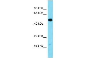 Western Blotting (WB) image for anti-Transmembrane Protein 39A (TMEM39A) (Middle Region) antibody (ABIN2791114) (TMEM39A 抗体  (Middle Region))