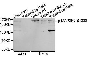 Western Blotting (WB) image for anti-Mitogen-Activated Protein Kinase Kinase Kinase 5 (MAP3K5) (pSer1033) antibody (ABIN3019485) (ASK1 抗体  (pSer1033))