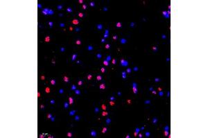 Immunofluorescence of paraffin embedded rat brain using MED17 (ABIN7074579) at dilution of 1:1500 (200x lens) (MED17 抗体)