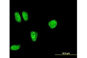 Image no. 2 for anti-Mitogen-Activated Protein Kinase Kinase 7 (MAP2K7) (AA 1-100) antibody (ABIN598899) (MAP2K7 抗体  (AA 1-100))