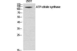 Western Blot (WB) analysis of specific cells using ATP-citrate synthase Polyclonal Antibody. (ACLY 抗体  (Ser1227))
