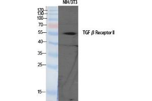 Western Blotting (WB) image for anti-Transforming Growth Factor, beta Receptor II (70/80kDa) (TGFBR2) (Ser225) antibody (ABIN5959892)
