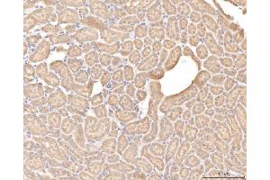 IHC analysis of BHMT using anti-BHMT antibody (ABIN7599940). (BHMT 抗体  (AA 13-386))
