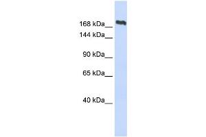 WB Suggested Anti-SMC2 Antibody Titration:  0. (SMC2 抗体  (Middle Region))
