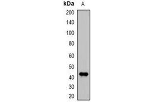 Western blot analysis of DDB2 expression in MCF7 (A) whole cell lysates. (DDB2 抗体)