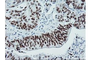 Image no. 3 for anti-Tumor Protein P53 (TP53) antibody (ABIN1499973) (p53 抗体)
