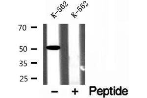 Western blot analysis of extracts of K-562 cells, using ZnT6 antibody. (SLC30A6 抗体  (Internal Region))