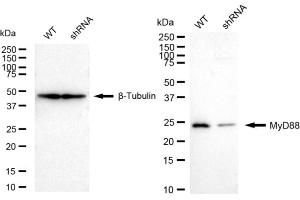 Western blotting analysis using MyD88 antibody (ABIN7799510). (Recombinant MYD88 抗体)