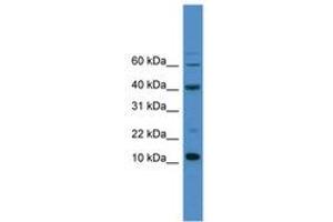 Image no. 1 for anti-Caspase 3 (CASP3) (AA 80-129) antibody (ABIN6745427) (Caspase 3 抗体  (AA 80-129))