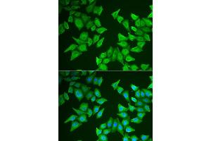 Immunofluorescence analysis of HeLa cell using ALAS2 antibody. (ALAS2 抗体)