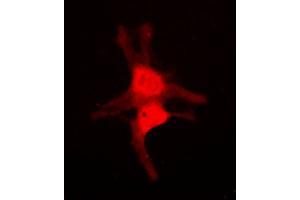 Immunofluorescent analysis of JNK3 staining in NIH3T3 cells. (MAPK10 抗体  (C-Term))