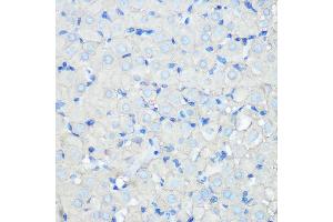Immunohistochemistry of paraffin-embedded rat ovary using SR-BI Rabbit mAb (ABIN7270156) at dilution of 1:100 (40x lens). (SCARB1 抗体)