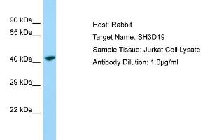 Host: Rabbit Target Name: SH3D19 Sample Type: Jurkat Whole Cell lysates Antibody Dilution: 1.