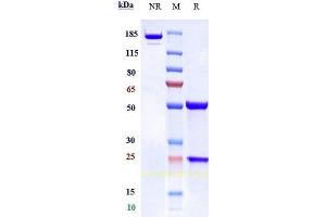 Anti-TFPI Reference Antibody (concizumab) on SDS-PAGE under reducing (R) condition. (Recombinant TFPI (Concizumab Biosimilar) 抗体)