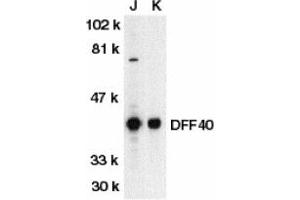 Image no. 1 for anti-DNA Fragmentation Factor, 40kDa, beta Polypeptide (Caspase-Activated DNase) (DFFB) (AA 3-18) antibody (ABIN203319) (DFFB 抗体  (AA 3-18))