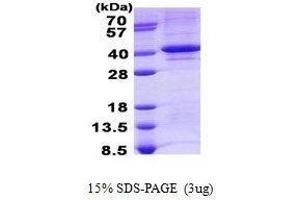 Figure annotation denotes ug of protein loaded and % gel used. (TDP1 蛋白)