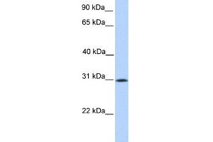 WB Suggested Anti-SIGLEC12 Antibody Titration:  0. (SIGLEC12 抗体  (N-Term))
