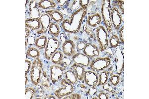 Immunohistochemistry (IHC) image for anti-Ataxin 3 (ATXN3) (AA 1-364) antibody (ABIN3021829)