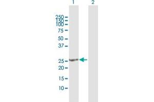 Western Blot analysis of SOHLH2 expression in transfected 293T cell line by SOHLH2 MaxPab polyclonal antibody.