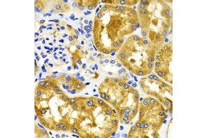 Immunohistochemistry of paraffin-embedded Human kidney using CDK20 antibody at dilution of 1:100 (x400 lens). (CCRK 抗体)