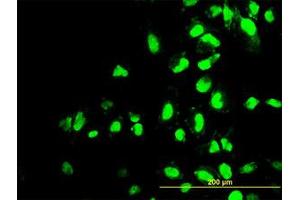 Image no. 3 for anti-Polymerase (RNA) I Polypeptide C, 30kDa (POLR1C) (AA 1-347) antibody (ABIN599083) (POLR1C 抗体  (AA 1-347))