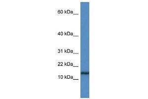Western Blot showing HIST1H3A antibody used at a concentration of 1 ug/ml against Jurkat Cell Lysate (HIST1H3A 抗体  (N-Term))