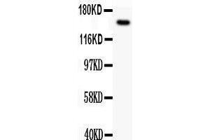 Observed bind size: 154KD (c-MET 抗体  (AA 208-407))