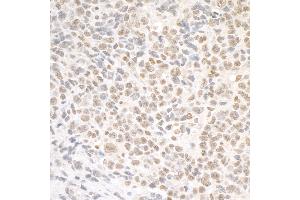 Immunohistochemistry (IHC) image for anti-Structural Maintenance of Chromosomes 1A (SMC1A) (C-Term) antibody (ABIN7453928) (SMC1A 抗体  (C-Term))
