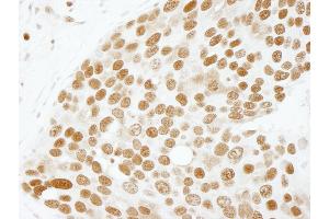 Immunohistochemistry (IHC) image for anti-Activated RNA Polymerase II Transcriptional Coactivator p15 (SUB1) (AA 77-127) antibody (ABIN7448719) (SUB1 抗体  (AA 77-127))