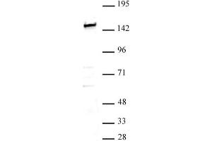 SMARCC1 / BAF155 antibody (pAb) tested by Western blot. (SMARCC1 抗体  (N-Term))
