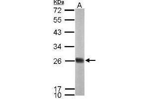 WB Image Sample (50 ug of whole cell lysate) A: mouse brain 12% SDS PAGE antibody diluted at 1:1000 (NDUFS8 抗体  (Center))