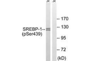 Western blot analysis of extracts from Jurkat cells treated with TNF 20ng/ml 30', using SREBP-1 (Phospho-Ser439) Antibody. (SREBF1 抗体  (pSer439))