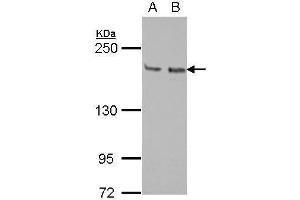 WB Image Sample (30 ug of whole cell lysate) A: Jurkat B: Raji 5% SDS PAGE antibody diluted at 1:1000 (KIF14 抗体  (N-Term))