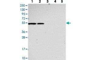 Western blot analysis of Lane 1: RT-4, Lane 2: U-251 MG, Lane 3: Human Plasma, Lane 4: Liver, Lane 5: Tonsil with SLC24A6 polyclonal antibody .