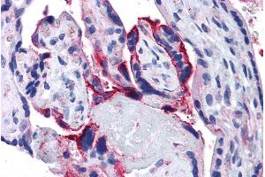 Immunohistochemistry (IHC) image for anti-Anterior Pharynx Defective 1 Homolog A (C. Elegans) (APH1A) (Internal Region) antibody (ABIN190762)