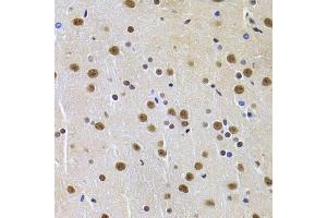 Immunohistochemistry of paraffin-embedded rat brain using PPP1R8 Antibody (ABIN5974046) at dilution of 1/100 (40x lens). (PPP1R8 抗体)