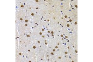 Immunohistochemistry of paraffin-embedded rat brain using PPP1R8 Antibody (ABIN5974046) at dilution of 1/100 (40x lens). (PPP1R8 抗体)