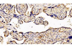 Detection of GCSFR in Human Placenta Tissue using Polyclonal Antibody to Colony Stimulating Factor Receptor, Granulocyte (GCSFR) (CSF3R 抗体  (AA 26-138))