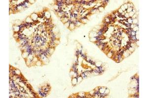 Immunohistochemistry of paraffin-embedded human small intestine tissue using ABIN7170368 at dilution of 1:100 (SNX18 抗体  (AA 449-628))