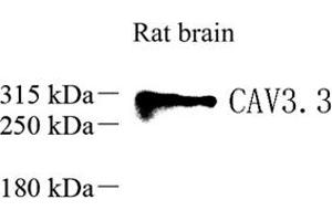 Western blot analysis of Ca(v)3. (CACNA1I 抗体)