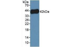 Detection of Recombinant PF4V1, Human using Polyclonal Antibody to Platelet Factor 4 Variant 1 (PF4V1) (PF4V1 抗体  (AA 1-104))