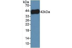 Detection of Recombinant PF4V1, Human using Polyclonal Antibody to Platelet Factor 4 Variant 1 (PF4V1)