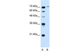 Image no. 1 for anti-Solute Carrier Organic Anion Transporter Family, Member 6A1 (SLCO6A1) (AA 101-150) antibody (ABIN205026) (SLCO6A1 抗体  (AA 101-150))