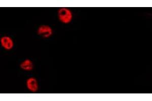 ABIN6278580 staining HepG2 by IF/ICC. (HIST1H2BH 抗体  (N-Term))