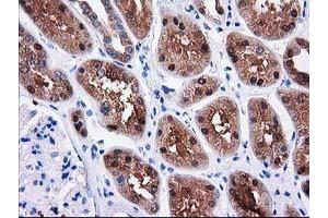 Immunohistochemical staining of paraffin-embedded Human Kidney tissue using anti-SULT1C2 mouse monoclonal antibody. (SULT1C2 抗体)