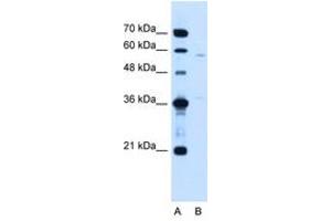 Image no. 1 for anti-Coiled-Coil Domain Containing 112 (CCDC112) (AA 71-120) antibody (ABIN205068) (CCDC112 抗体  (AA 71-120))