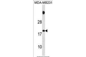 SPNXB Antibody (Center) (ABIN1881824 and ABIN2839075) western blot analysis in MDA-M cell line lysates (35 μg/lane). (SPANXB1 抗体  (AA 17-47))