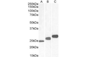 Antibody (0. (CSNK2B 抗体  (Internal Region))