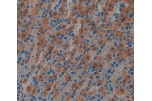 Used in DAB staining on fromalin fixed paraffin- embedded stomach tissue (MATK 抗体  (AA 1-173))