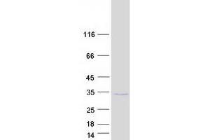 Western Blotting (WB) image for Calpain, Small Subunit 1 (CAPNS1) (Transcript Variant 2) protein (Myc-DYKDDDDK Tag) (ABIN2713112)